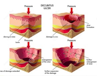 dd59bab72d5031e218a440fb0b0ad42.png